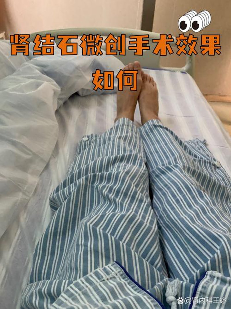 包皮手术：轻松告别男性健康困惑
