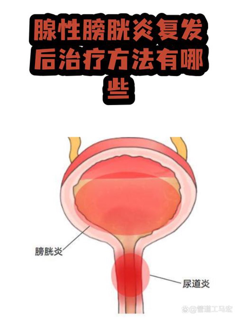 包皮手术费用