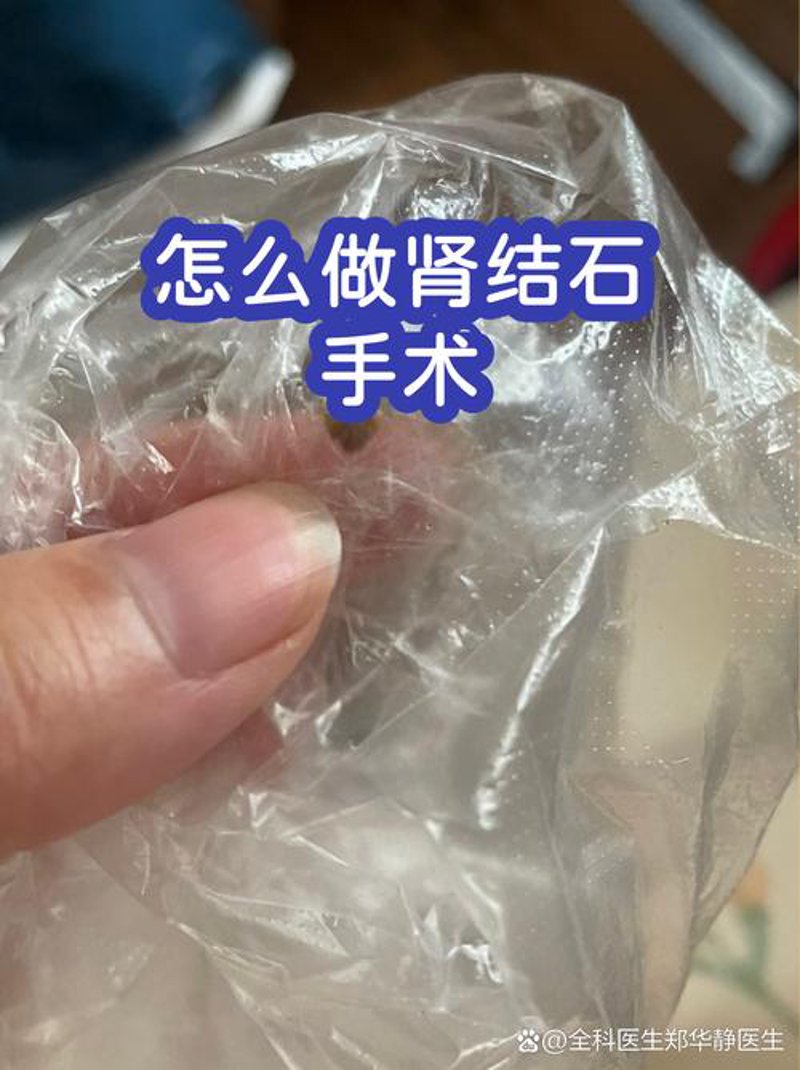 杭州泌尿外科医院行业动态